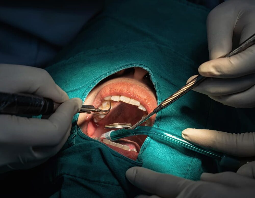 Cirugía preprotésica y de exposición dental