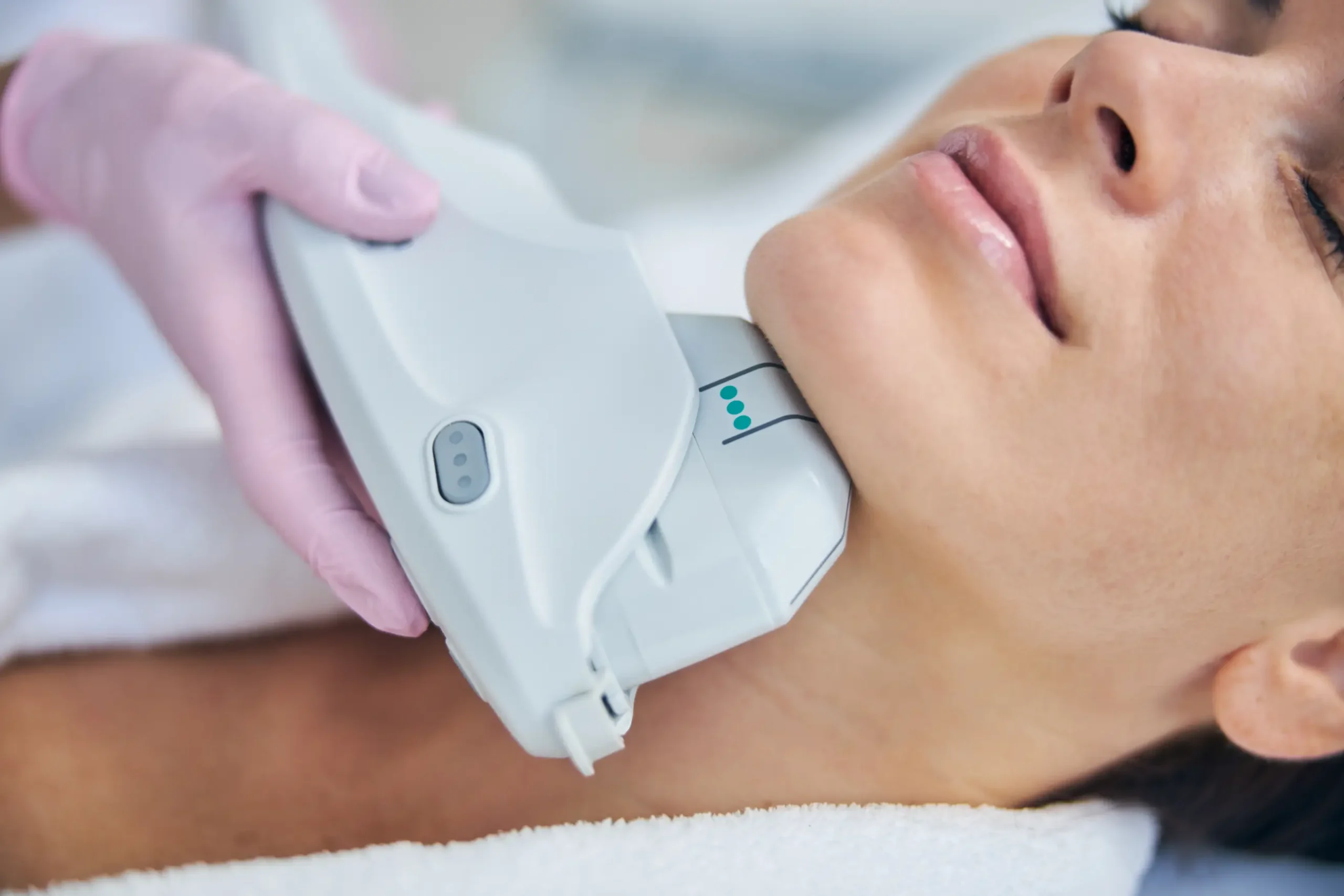 HIFU y radiofrecuencia facial en Bilbao y Bizkaia
